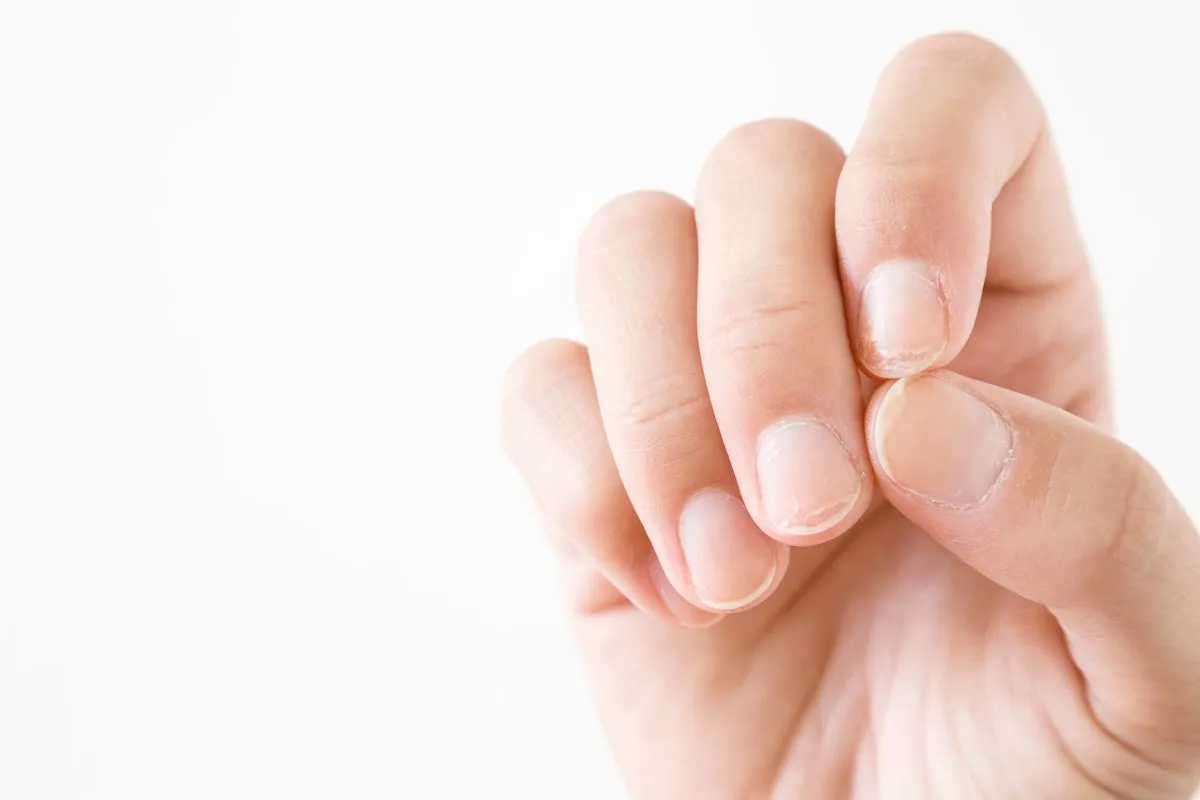 Nail Repair Procedures and Products