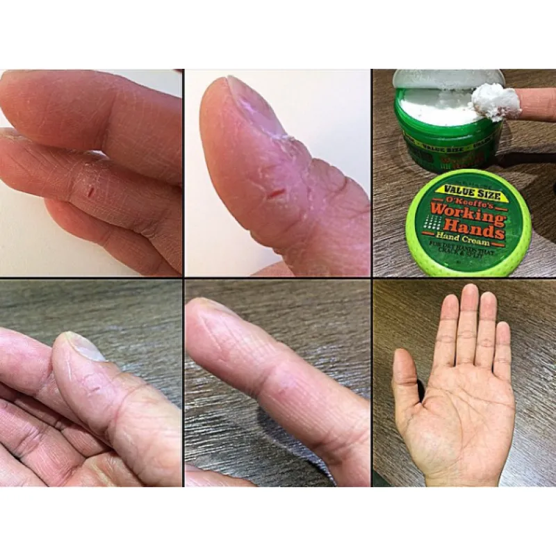 O’Keeffe’s Working Hands Cream: Ultimate Relief for Cracked Hands