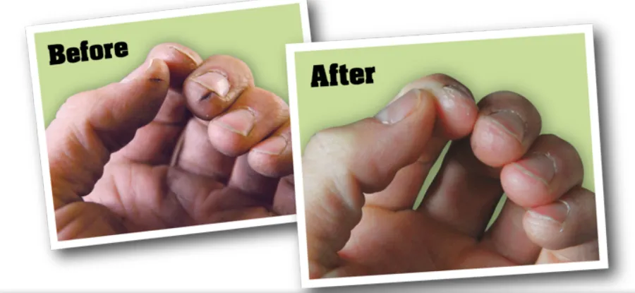 O’Keeffe’s Working Hands Cream: Ultimate Relief for Cracked Hands
